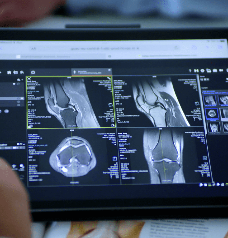 <strong>SmartSimulator: simulación para radiología</strong>